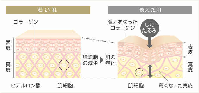 肌細胞注入療法